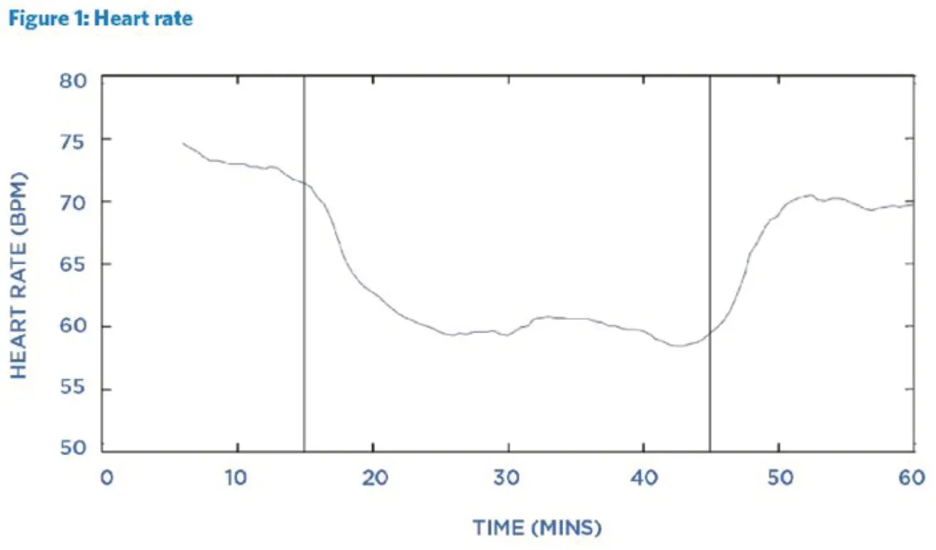 Figure 1: Heart rate. Heart rate in beats per minute over a 60-minute session, with the NuCalm session marked by vertical lines